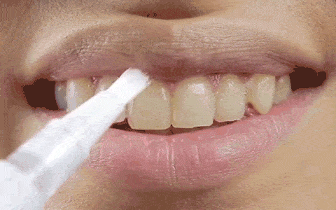 Tooth whitening pencil Dazzling White #1