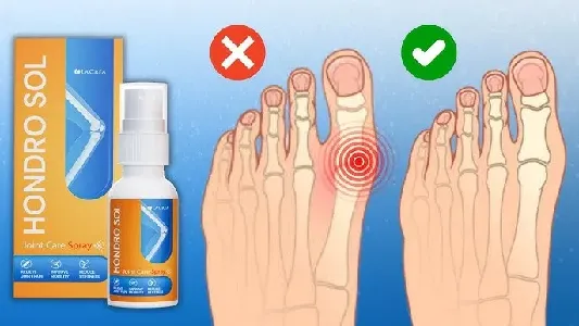 Hondro Sol Valgus Spray #1